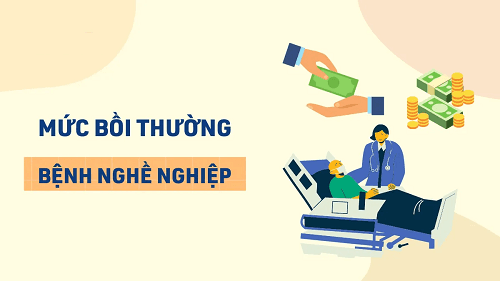 Mức bồi thường bệnh nghề nghiệp dành cho người lao động